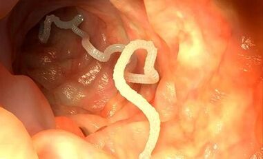 oorzaken van parasieten in het menselijk lichaam