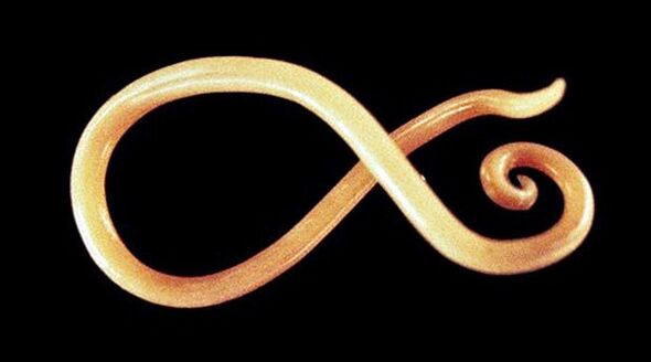 nematodenworm uit het menselijk lichaam