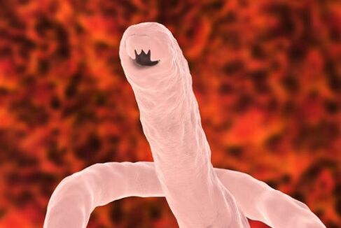 wormparasiet van de mens